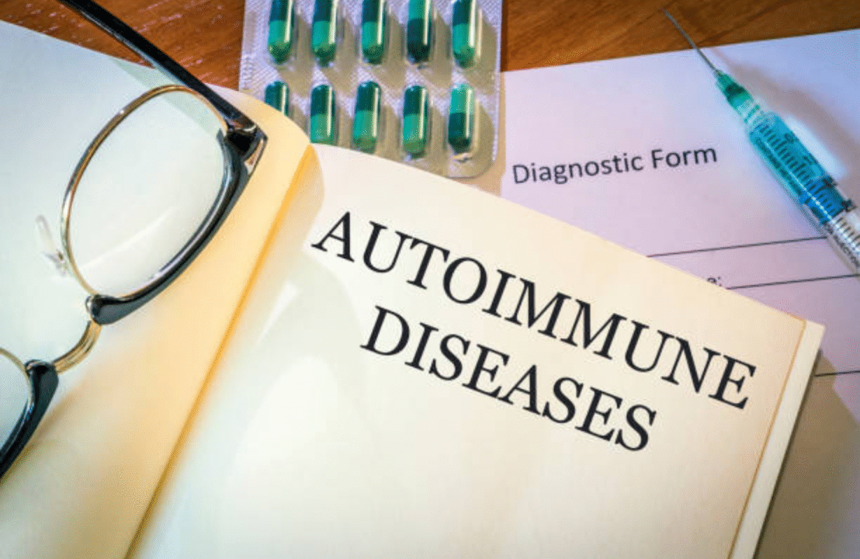 Hydroxychloroquine Dose for Autoimmune Diseases